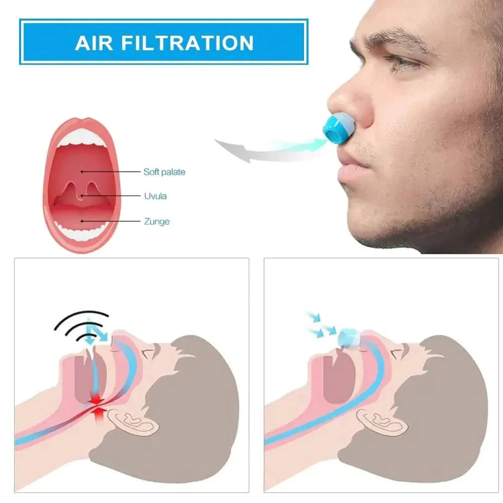 Micro CPAP Anti-Snurkapparaat – Draadloos & Oplaadbaar Alternatief voor Snurkbehandeling en Slaapapneu | Reisklaar & Stil